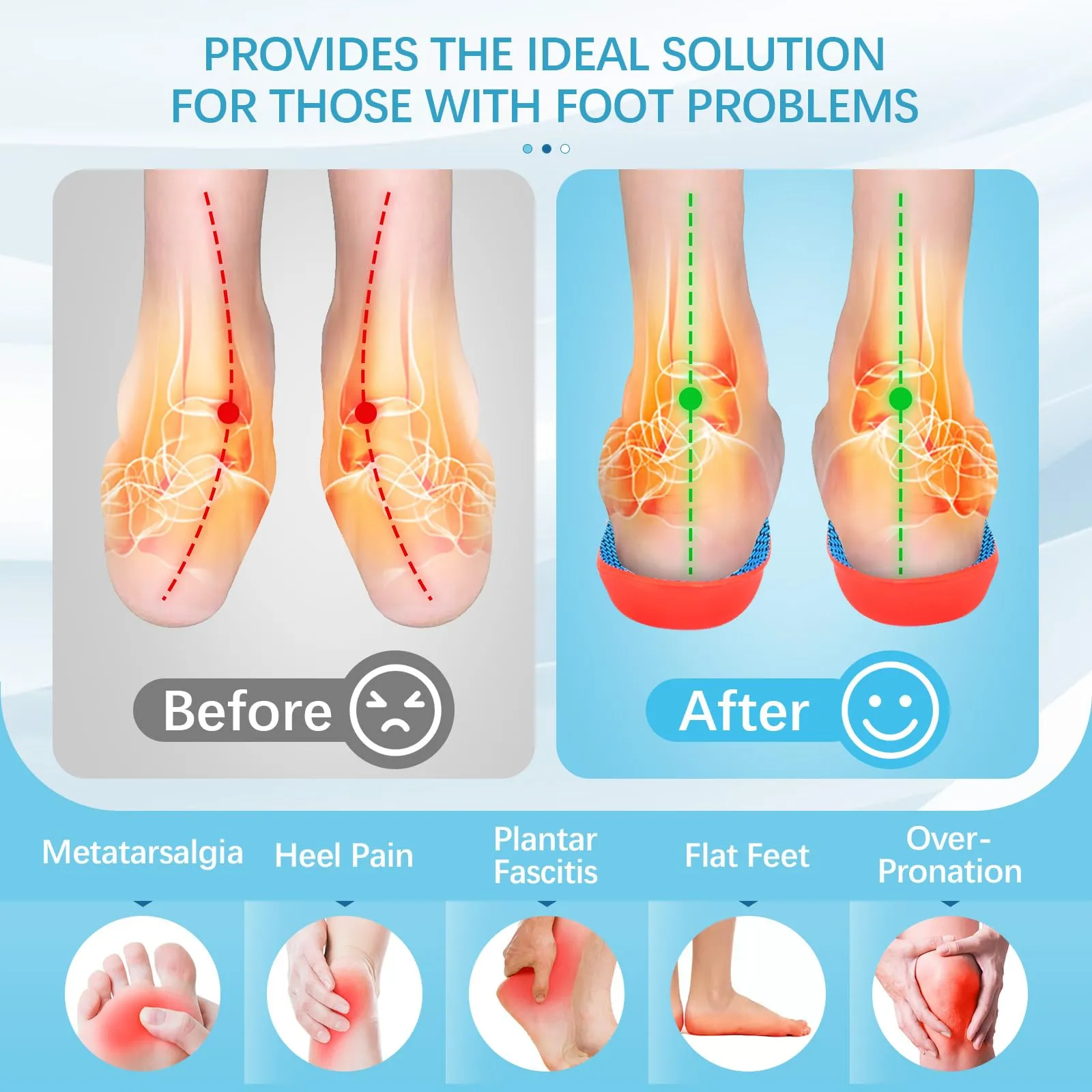 2 pairs of orthopedic insoles, heel spur insoles, arch splayfoot insoles for plantar fasciitis, comfort arch support insoles for men and women, orthopedic insoles for men and women 41-42